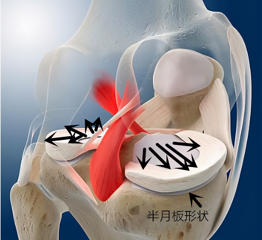 膝盖总是疼半月板损伤怎么治,膝盖一直痛是什么病