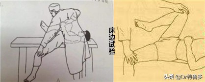 生完孩子几年打麻醉腰痛怎么办,生完宝宝后腰痛是什么原因