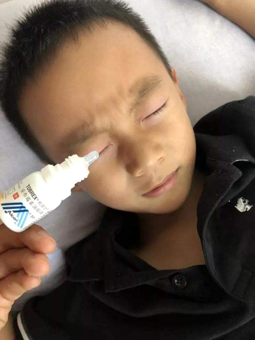 502胶水误当眼药水,错把502的胶水当眼药水