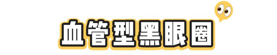 黑眼圈分几种怎么治,黑眼圈的种类和解决办法