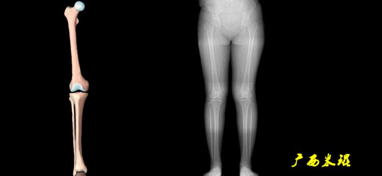 广西骨科医生米琨最新信息,米琨广西骨科什么水平