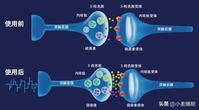 大脑失眠焦虑,严重失眠心理焦虑