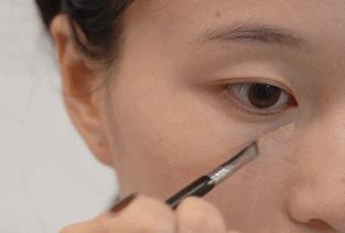 凹面型侧脸怎么改善,凹面型侧脸是怎么造成的