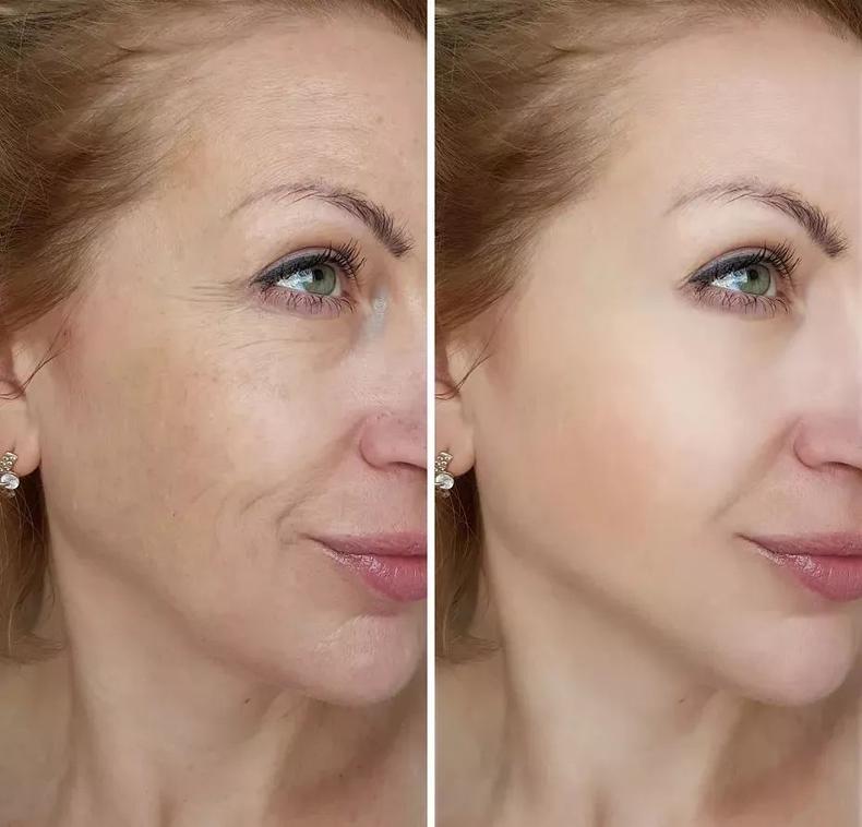 脸上胶原蛋白流失的表现,用什么挽留你的胶原蛋白