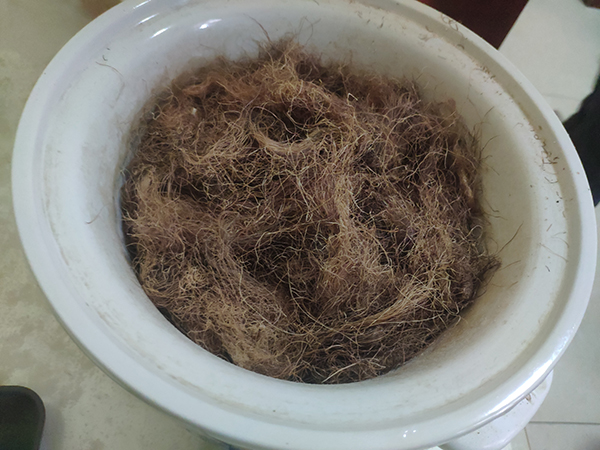 知名中医免费给小伙治疗尿毒症,南京特别厉害治疗尿毒症老中医