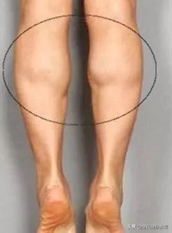 女孩子小腿粗壮如何瘦肌肉腿,小腿肉结实怎样瘦小腿肚