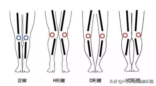 大腿比头还粗,你确定要胖罐子胖摔?肥宅逆袭只差这一步