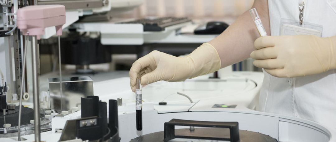 医药血制品都有啥投资,医药领域两票制