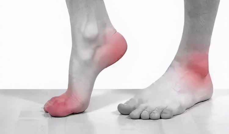 痛风患者适合经常吃什么食物,痛风发作时可以吃什么食物好