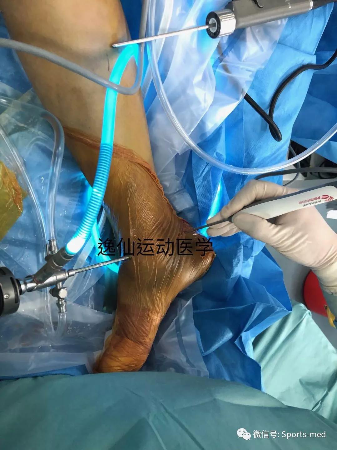 涓嶅ソ鎯圭殑浜虹殑涓夊ぇ鐗圭偣,涓夎闊у甫鎷夐暱