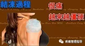 肩周炎的原因与锻炼方法