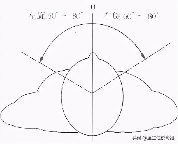 产后颈肩腰腿疼怎么调理,产后脖子疼怎么回事啊