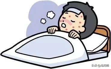 麻疹草药止痒,麻疹最好的中药方子