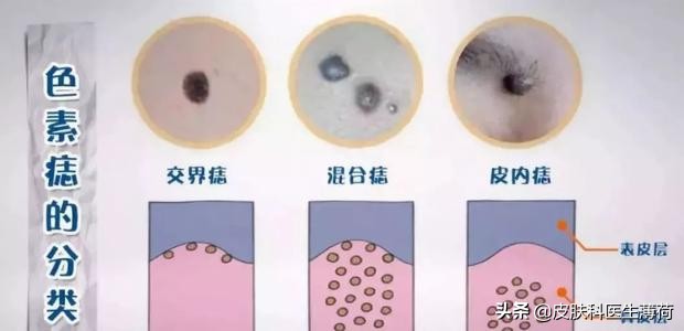 脸上激光了能喝中药吗,激光祛斑可以喝中药吗