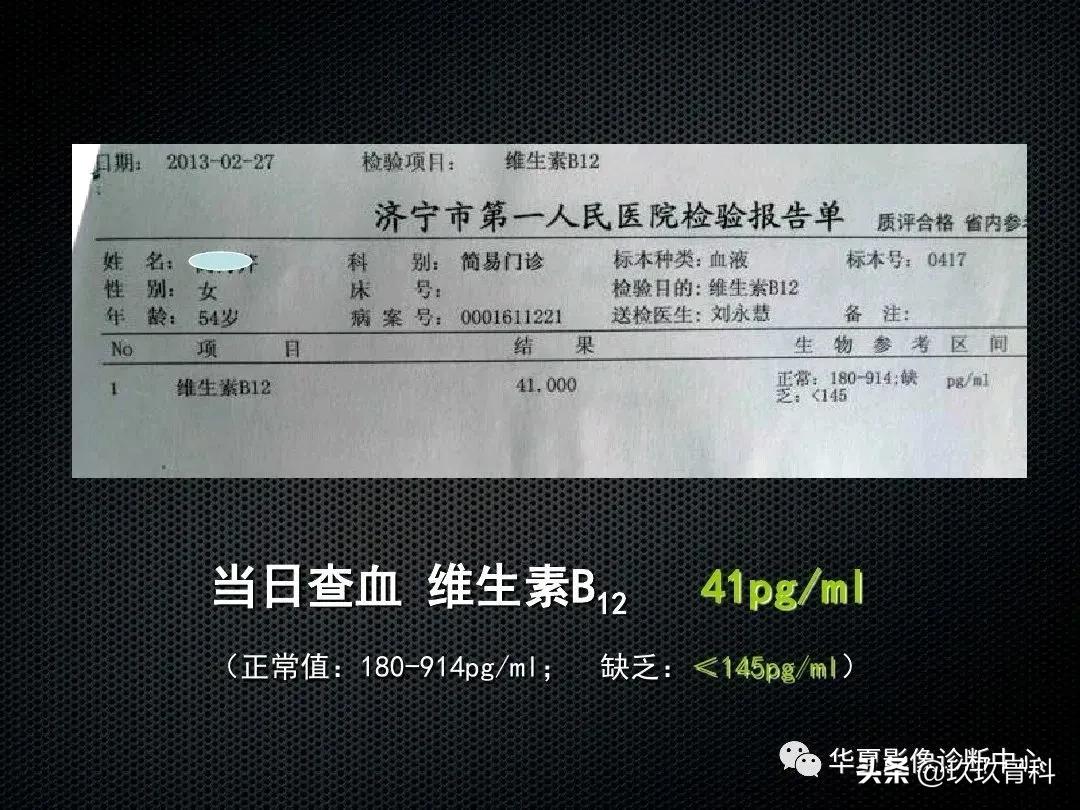 颈椎病脊髓变性mri表现,脊髓亚急性联合变性的诊断