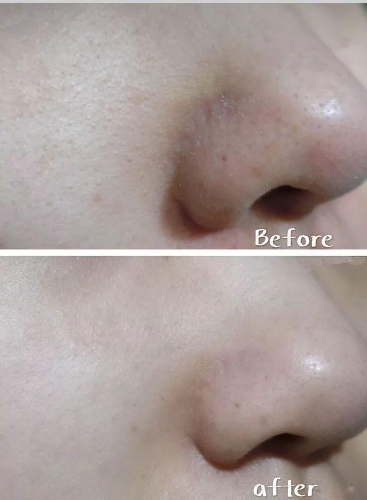 吴昕推荐的洗面奶测评,吴昕同款洗面奶pola