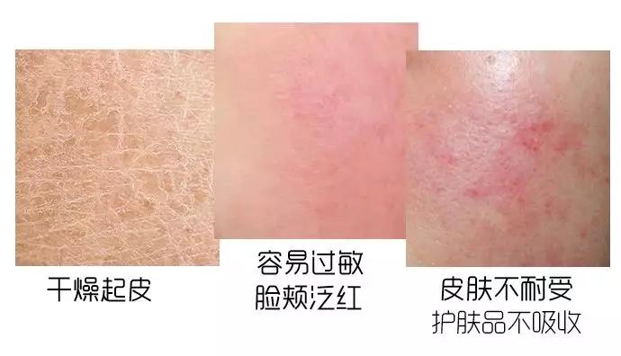 curel珂润水乳闭口,日本curel珂润身体乳液