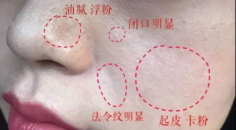 空调房皮肤干燥痒怎么快速解决,屋里干燥皮肤痒