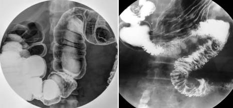 造影检查对身体的伤害大吗,造影对一般检查有必要吗
