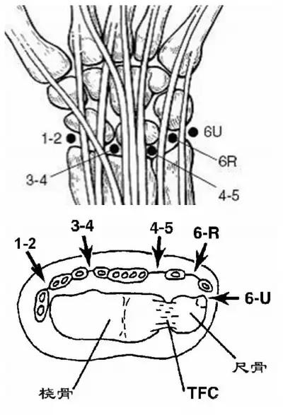 腱鞘囊肿除了手术还有什么办法,下颚有囊肿可以做穿刺手术