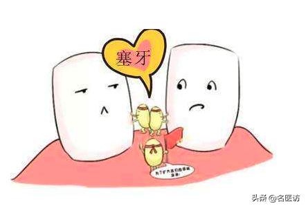 塞牙代表牙坏了吗,牙齿长期塞牙会蛀牙吗