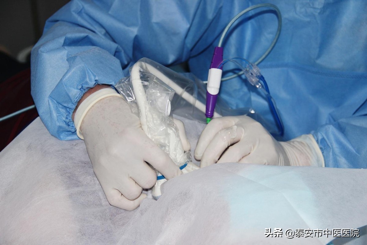 304医院甲状腺射频消融术,甲状腺肿瘤微创消融针视频