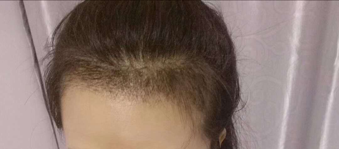 怎么让头发变得又黑又亮有光泽,如何保养头发让头发又黑又浓