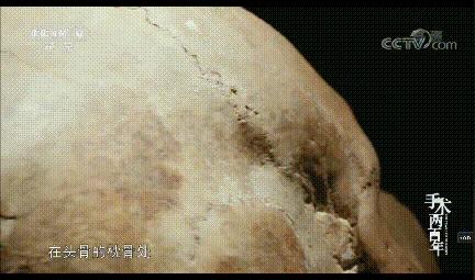 极限挑战：缝合人体最神秘的器官