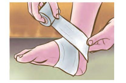 脚踝扭伤一般多久能揉,教你脚踝扭伤的正确紧急处理方法