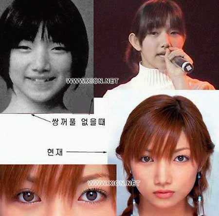 日本整容惊人案例,日本整容是不是最先进