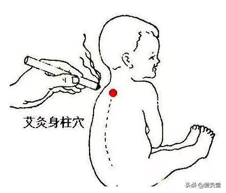 夏天艾灸该艾灸哪几个位置,又到了艾灸的季节