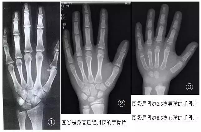 中国优生协会讲座,中国优生协会家庭教育