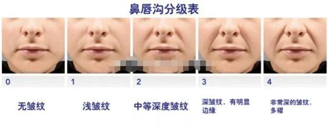 如何把法令纹变成一件高级的事