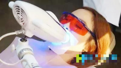 皓齿和冷光美白牙齿哪个好,效果好的牙齿冷光美白成功案例