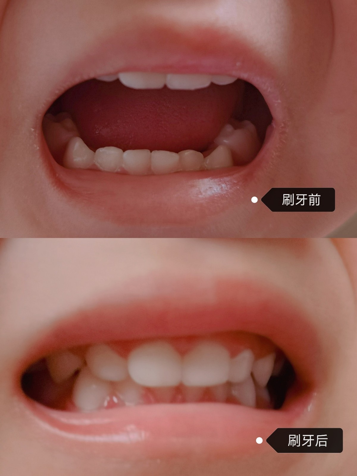 让宝宝爱上刷牙口含式电动牙刷,宝宝不爱刷牙用这款u型牙刷