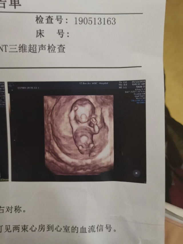 我的孕期记录,用什么记录孕期