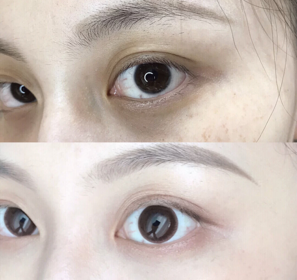 消除黑眼圈的最快方法,消除黑眼圈的方法