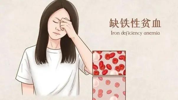 普通贫血和缺铁性贫血如何补血,缺铁性贫血与慢性贫血的鉴别方法