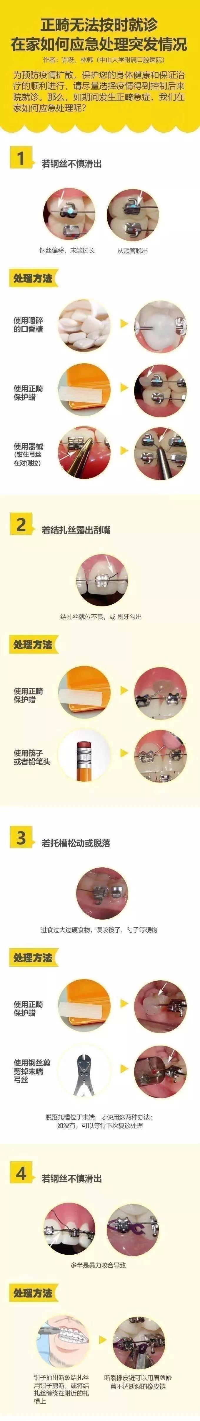 日常的牙病如何护理,疫情期间牙齿怎么修复