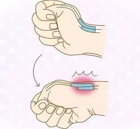 大拇指不敢动,大拇指腱鞘炎不疼有轻微的弹响