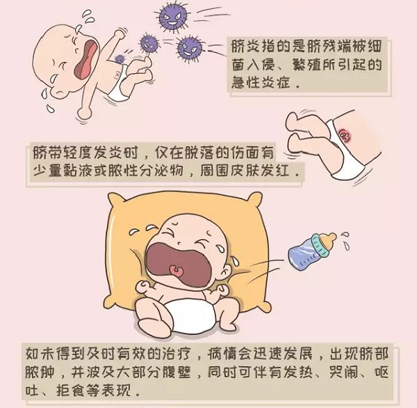 新生儿出生的第一周,看看有哪些特殊生理现象,宝妈怎样护理