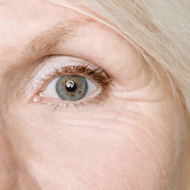 干纹细纹和皱纹统称什么,内眼角细纹是皱纹还是干纹