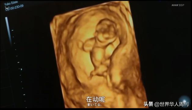 70岁生第一个孩子完整版,70岁生第一个孩子很丢人吗