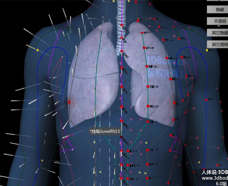 针灸肩井穴一般多深会导致气胸,针灸气胸紧急处理