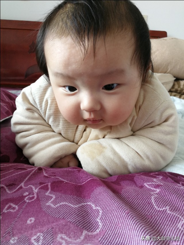 小儿湿疹严重有没有好办法,小儿湿疹需要注意什么