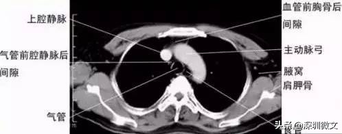 x光ct和核磁共振分别多少钱,ct与x光与核磁共振的区别是什么
