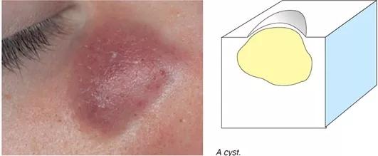 痘痘为什么越来越多如何正确祛痘,祛痘痘的效果是长痘痘还是消痘痘