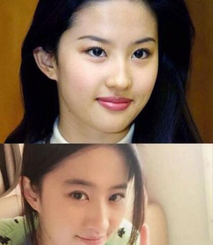 颧骨高太阳穴凹陷怎么改变面相,人中长颧骨高适合什么发型