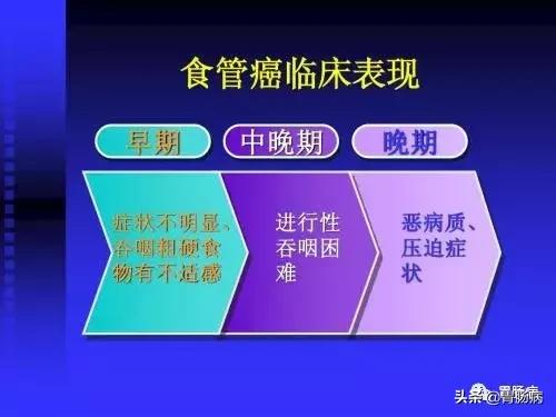反流性食管癌晚期症状有哪些,食管癌六大症状提示已到晚期