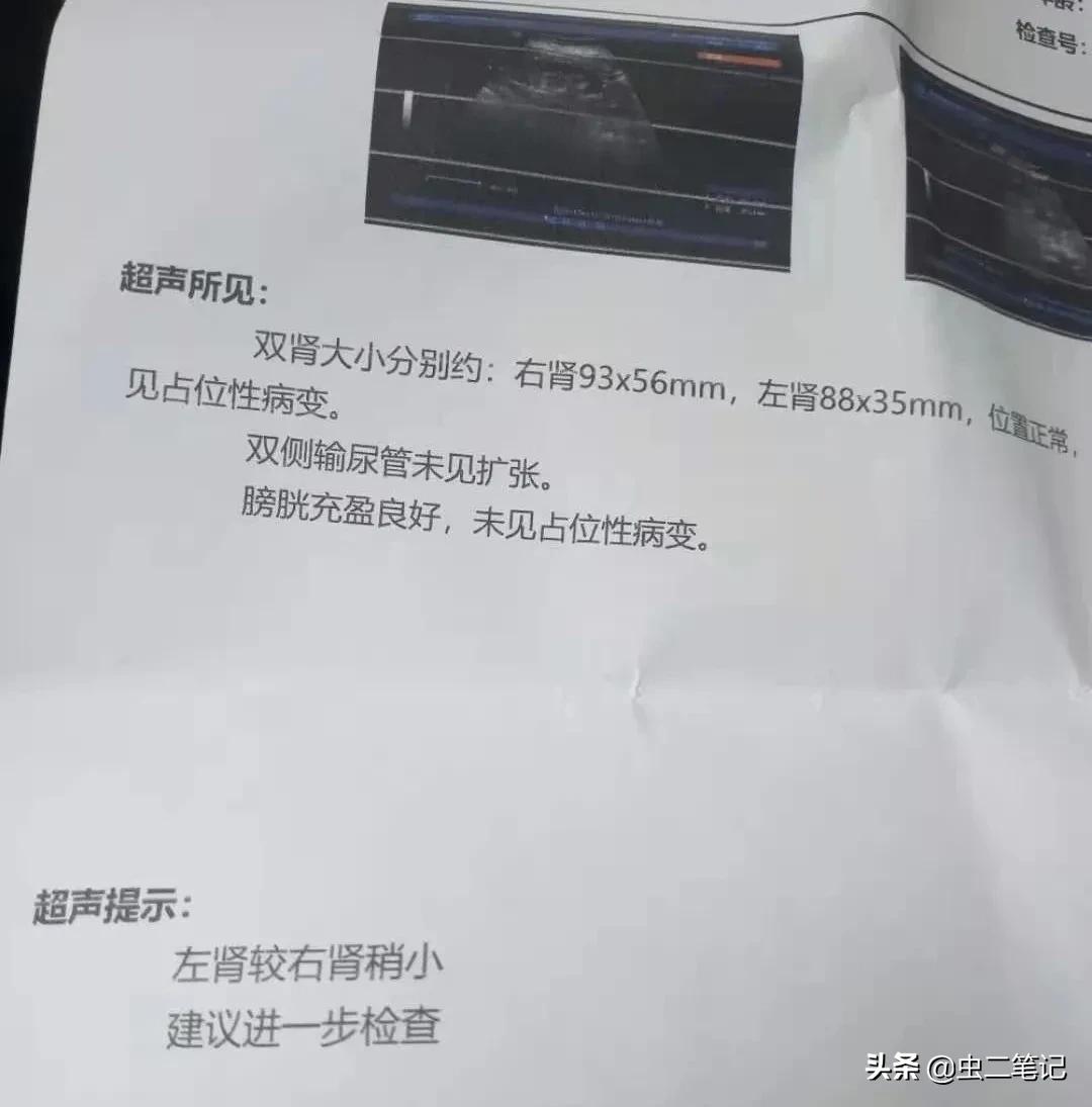 中医治疗母亲肾衰竭,母亲得了肾衰竭怎样治疗